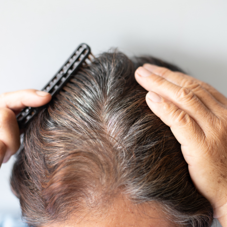 hair trikos